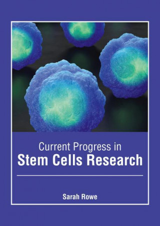 Current Progress in Stem Cells Research