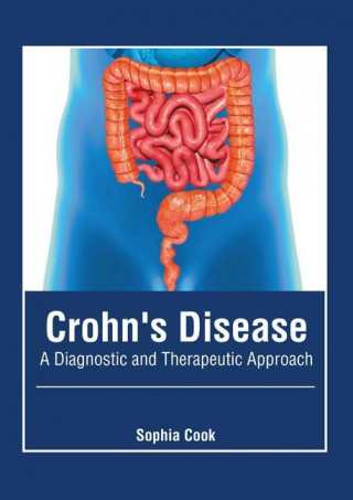 Crohn's Disease: A Diagnostic and Therapeutic Approach