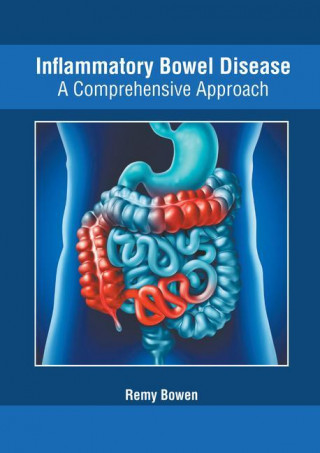 Inflammatory Bowel Disease: A Comprehensive Approach