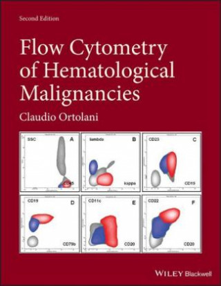 Flow Cytometry of Hematological Malignancies 2nd Edition