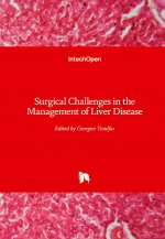 Surgical Challenges in the Management of Liver Disease