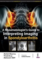 Rheumatologist's Guide to Interpreting Imaging in Spondyloarthritis