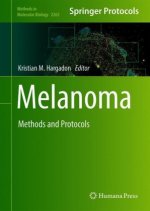 Melanoma