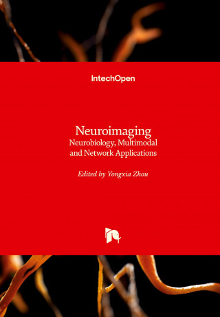 Neuroimaging