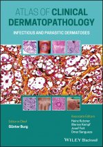 Atlas of Clinical Dermatopathology - Infectious and Parasitic Dermatoses