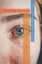 Annihilate Your Acne: How to Get Rid of Acne and Create Beautiful, Clear Skin; Your Easy, Proven Plan to Get Rid of Acne Fast