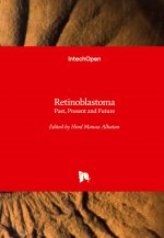 Retinoblastoma