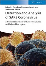 Detection and Analysis of SARS Coronavirus - Advanced Biosensors for Pandemic Viruses and Related Pathogens