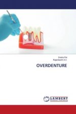 Overdenture