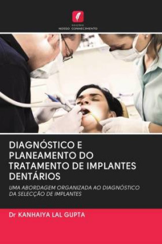 Diagnostico E Planeamento Do Tratamento de Implantes Dentarios