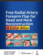 Free Radial Artery Forearm Flap for Head and Neck Reconstruction