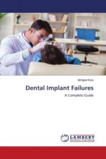 Dental Implant Failures