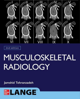 Basic Musculoskeletal Imaging, Second Edition