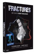 FRACTURES