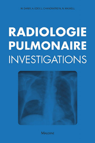 Radiologie pulmonaire : investigations