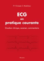 ECG en pratique courante - situation clinique, interprétation, décision