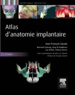 Atlas d'anatomie implantaire