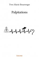 Palpitations