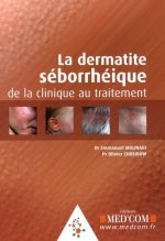 LA DERMITE SEBORRHEIQUE DE LA CLINIQUE AU TRAITEMENT