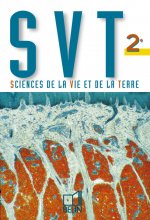 SVT - 2e
