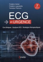 ECG en urgence