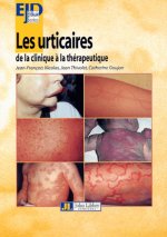 Les Urticaires-De La Clinique A La Therapeutique