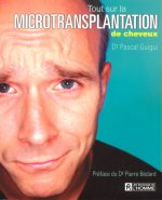 TOUT MICROTRANSPLANT CHEVEUX