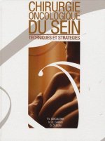 CHIRURGIE ONCOLOGIQUE DU SEIN TECHNIQUES ET STRATEGIES