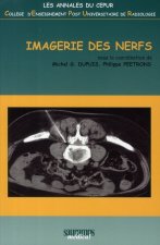 IMAGERIE DES NERFS CEPUR