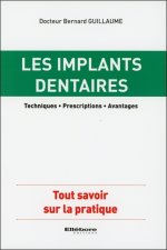 Les implants dentaires - Techniques - Prescriptions - Avantages