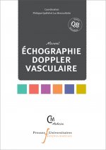 Echographie doppler vasculaire