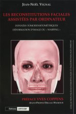 Reconstitutions faciales assistees par ordinateur (Les)