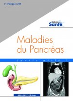 MALADIES DU PANCRÉAS : savoir utile ! (pancréatites et cancers du pancréas)