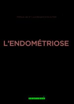 Soulager l'endométriose sans médicaments