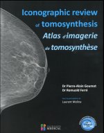 ICONOGRAPHIC REVIEW OF TOMOSYNTHESIS. ATLAS D IMAGERIE DE TOMOSYNTHESE