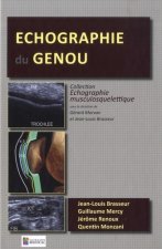 ECHOGRAPHIE DU GENOU