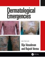 Dermatological Emergencies