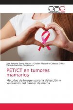 PET/CT en tumores mamarios