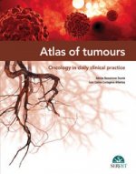 ATLAS OF TUMOURS ONCOLOGY IN DAILY CLINI