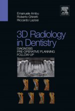 3D RADIOLOGY IN DENTISTRY DIAGNOSIS PREO