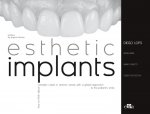 ESTHETIC IMPLANTS HOW TO THINK ABOUT COM