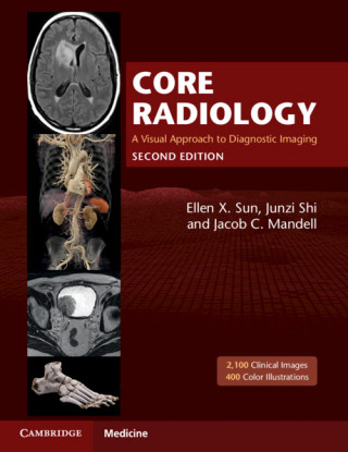 Core Radiology A Visual Approach to Diagnostic Imaging  - Multiple copy pack