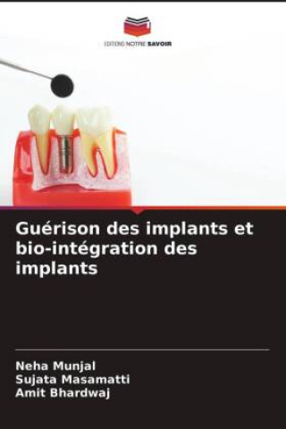 Guerison des implants et bio-integration des implants