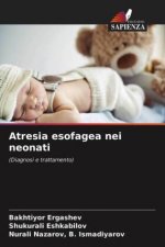 Atresia esofagea nei neonati