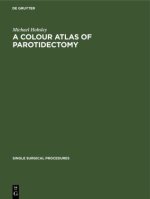 Colour Atlas of Parotidectomy