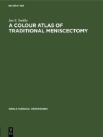 Colour Atlas of Traditional Meniscectomy