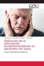 Disfuncion de la articulacion temporomandibular en pacientes con lupus