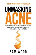 Unmasking Acne