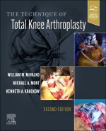 Technique of Total Knee Arthroplasty