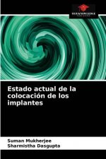 Estado actual de la colocacion de los implantes